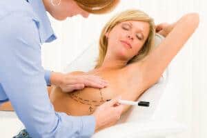 What Happens In A Breast Implant Surgery Facts You Need To Know