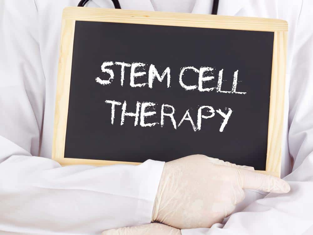 What You Need To Know About Stem Cell Therapy