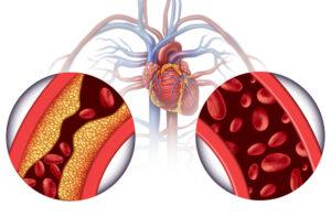 Unlocking The Benefits Of Chelation Therapy How You Can Rediscover Better Health