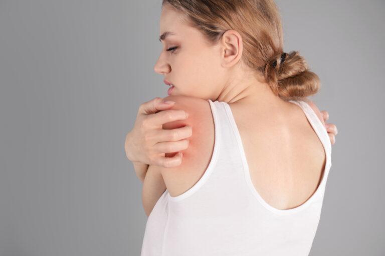 How To Treat Itchy Skin At Night