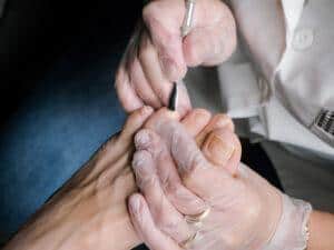 Ingrown Toenail Relief Navigating Specialized Solutions In Tampa Bay