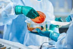 A New Chapter Understanding The Process Of Breast Implant Removal