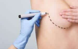 transformative-confidence-navigating-the-landscape-of-breast-surgery